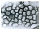 Ａ型インフルエンザの透過電子顕微鏡写真